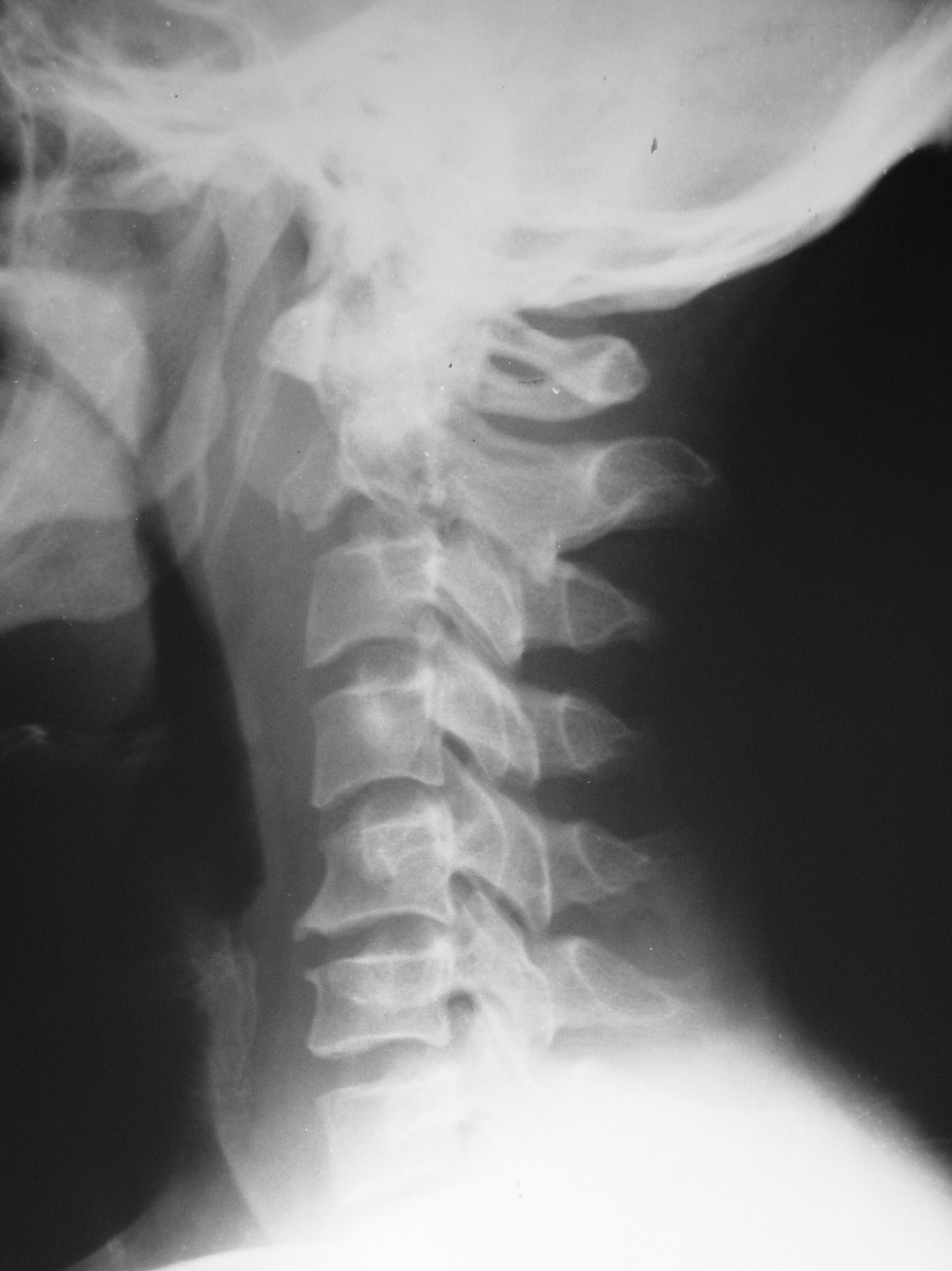 UCSD Musculoskeletal Radiology